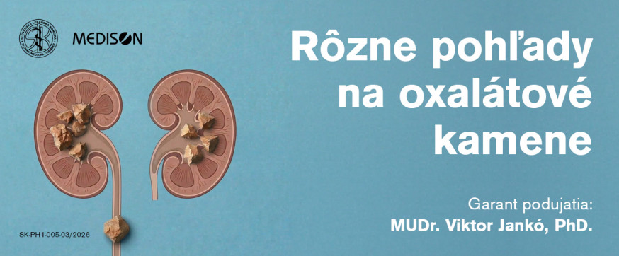 Banner | Rôzne pohľady na oxalátové kamene